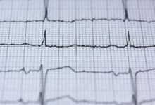 luminous growth node identified